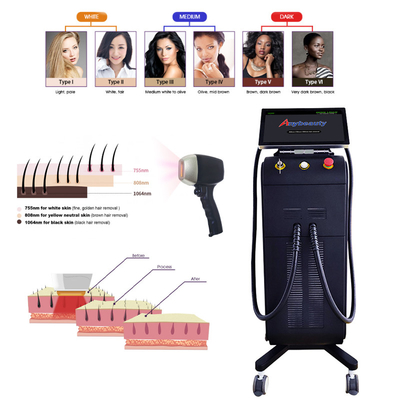 Painless Fast Full Body CE 808 Diode Laser Hair Removal Machine