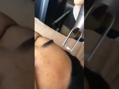 3-in-1 Picosecond Laser Machine - Remove Spots & Tattoos Safely