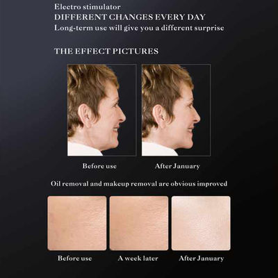 Commercial Non Invasive Skin Rejuvenation Machine , Stand Alone Skin Tightening Machine